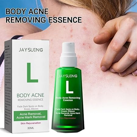 Body Pimple Repair Moisturizer