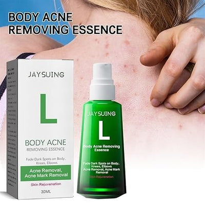 Body Pimple Repair Moisturizer