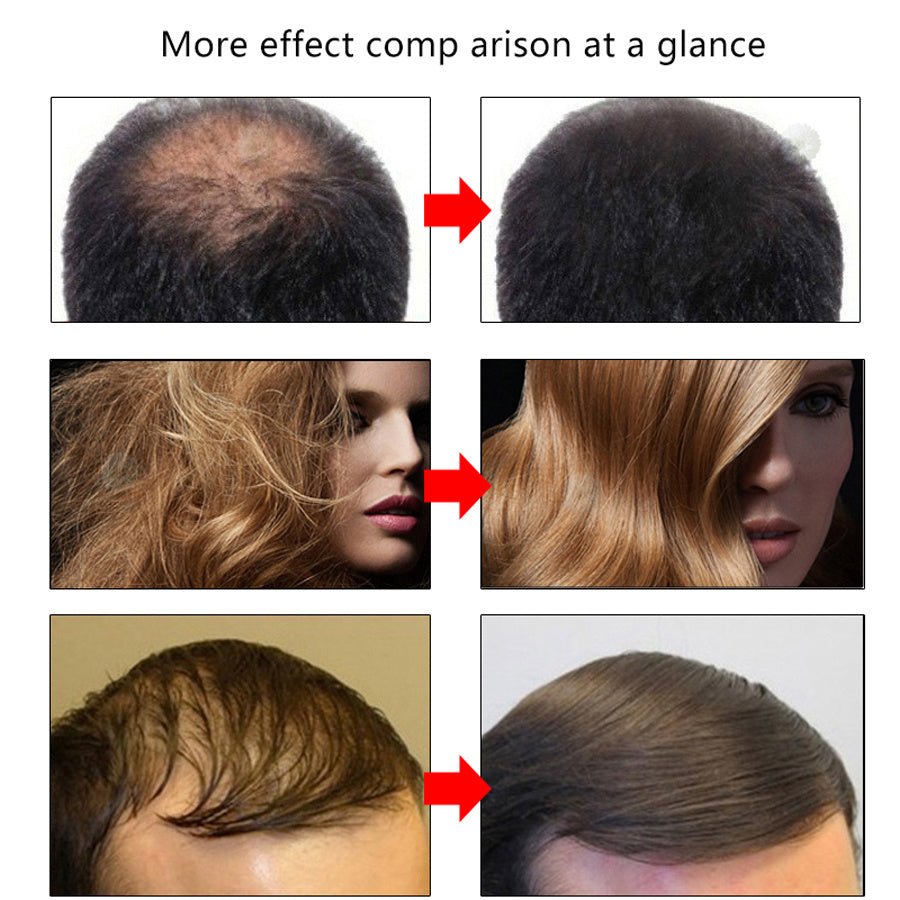 Efero Hair Growth Fluid