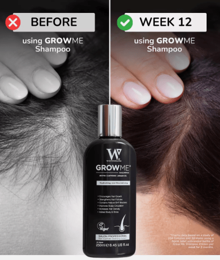 Hair Growth Shampoo (Original)