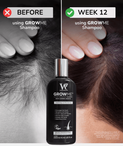 Hair Growth Shampoo (Original)