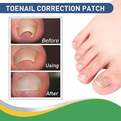 Hanel - Pain Relief Patch (Original)
