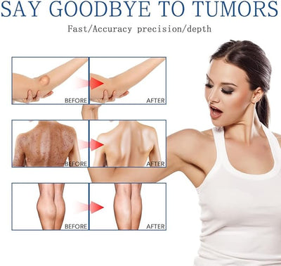 Instant Removal Cream