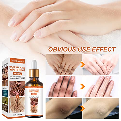 Skin Brightening Serum (Original)