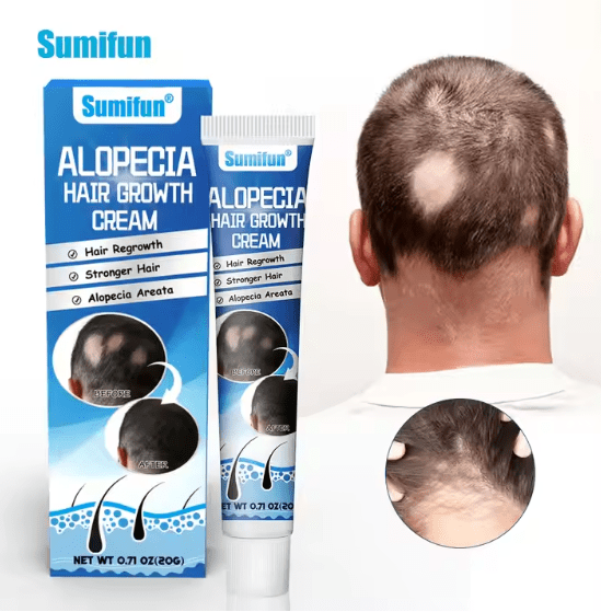 Sumifun - Hair Growth Cream (Original)