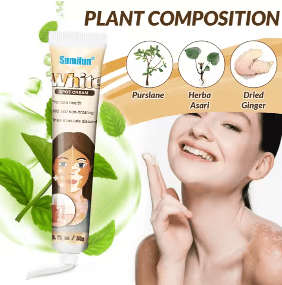 Sumifun - Vitiligo Removal Cream (Original)
